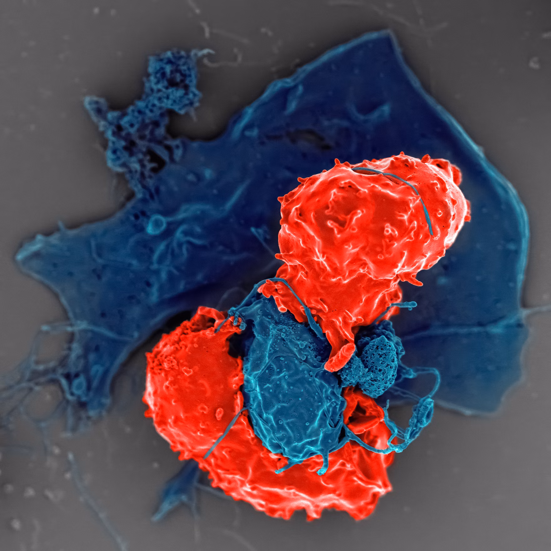 Tumor Microenvironment Agents